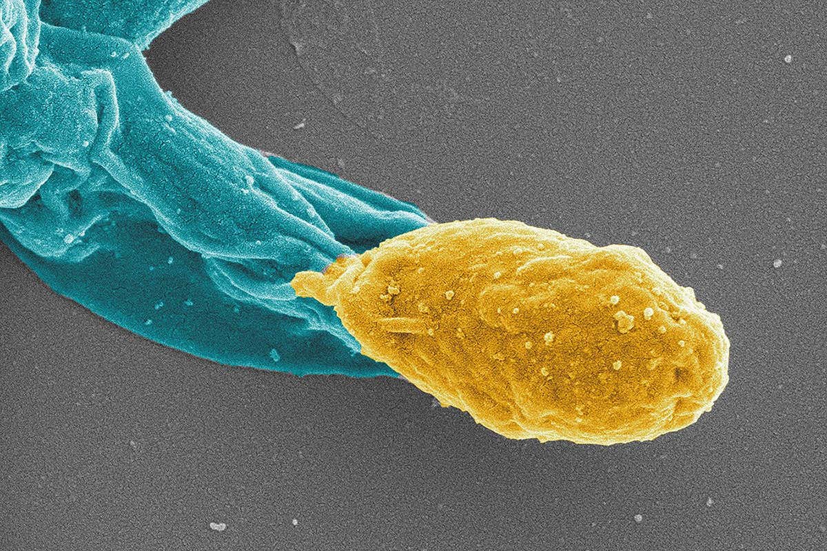 C. difficile spore in gold emerges from a bacterium in turquoise